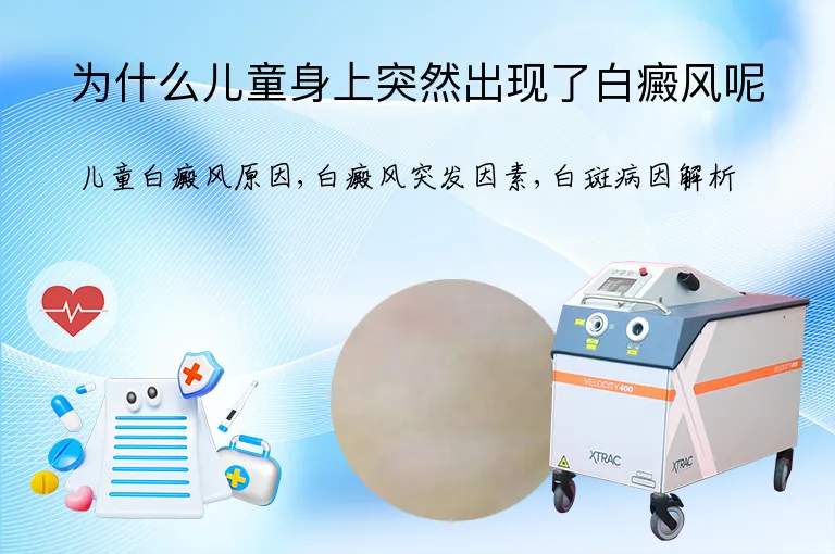 为什么儿童身上突然出现了白癜风呢