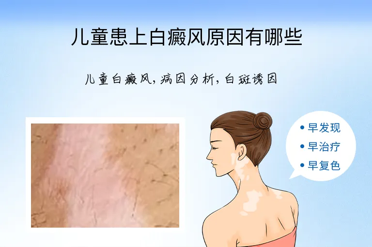 儿童患上白癜风原因有哪些