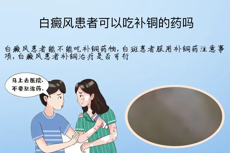 白癜风患者可以吃补铜的药吗