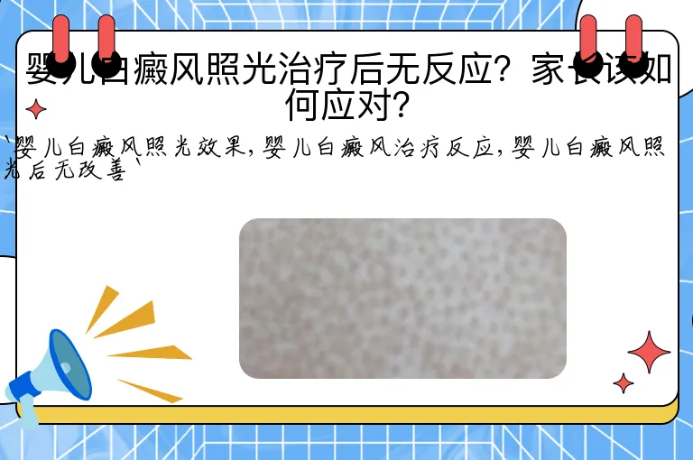 婴儿白癜风照光治疗后无反应？家长该如何应对？
