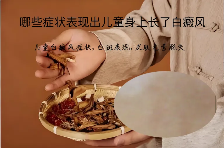 哪些症状表现出儿童身上长了白癜风
