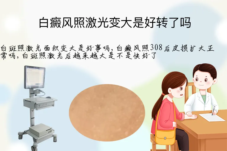 白癜风照激光变大是好转了吗