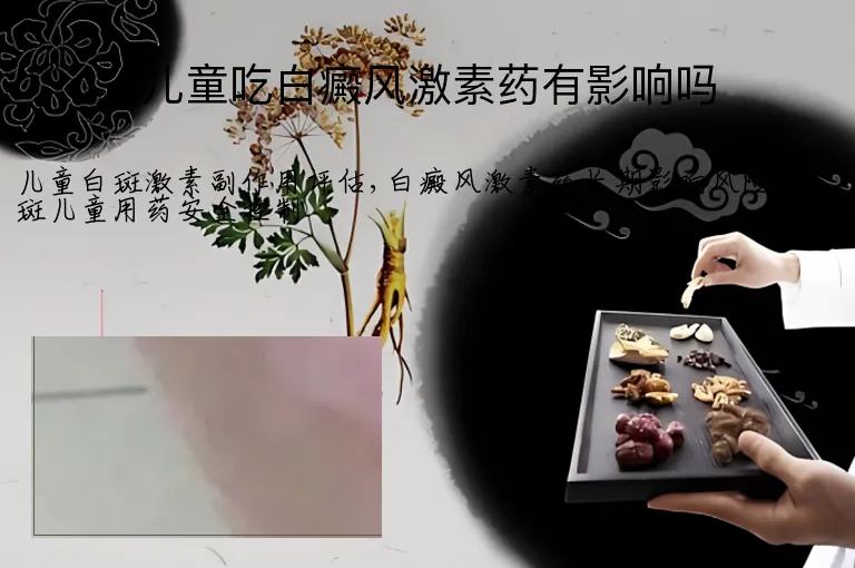 儿童吃白癜风激素药有影响吗