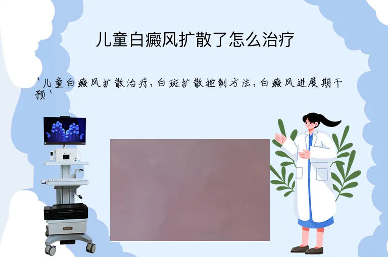 儿童白癜风扩散了怎么治疗