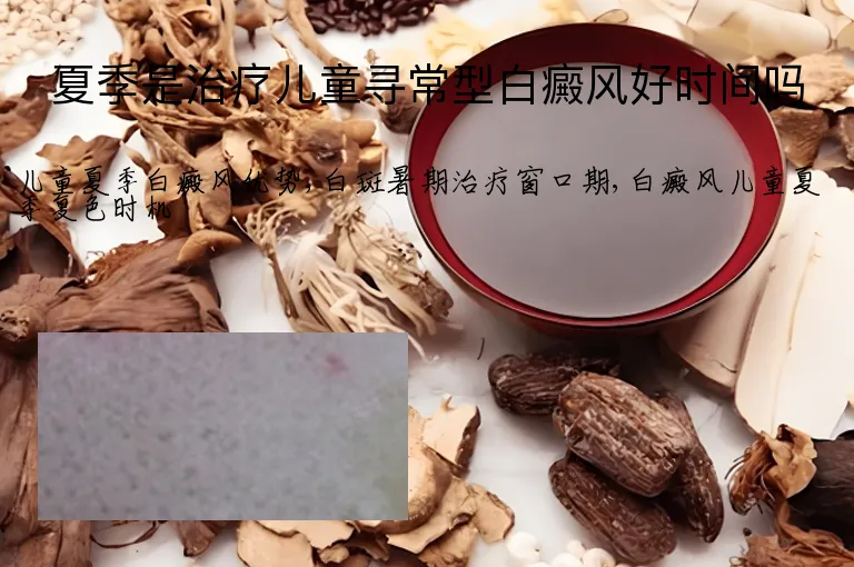 夏季是治疗儿童寻常型白癜风好时间吗