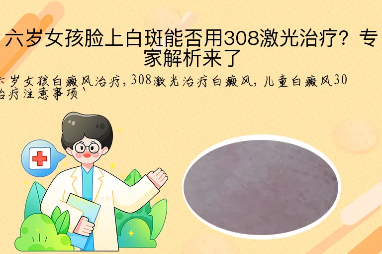 六岁女孩脸上白斑能否用308激光治疗？专家解析来了