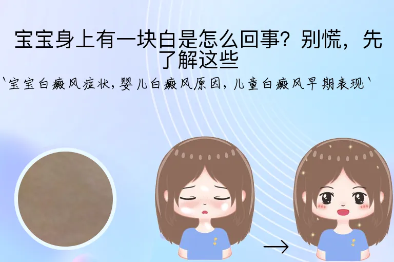 宝宝身上有一块白是怎么回事？别慌，先了解这些