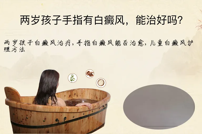 两岁孩子手指有白癜风，能治好吗？