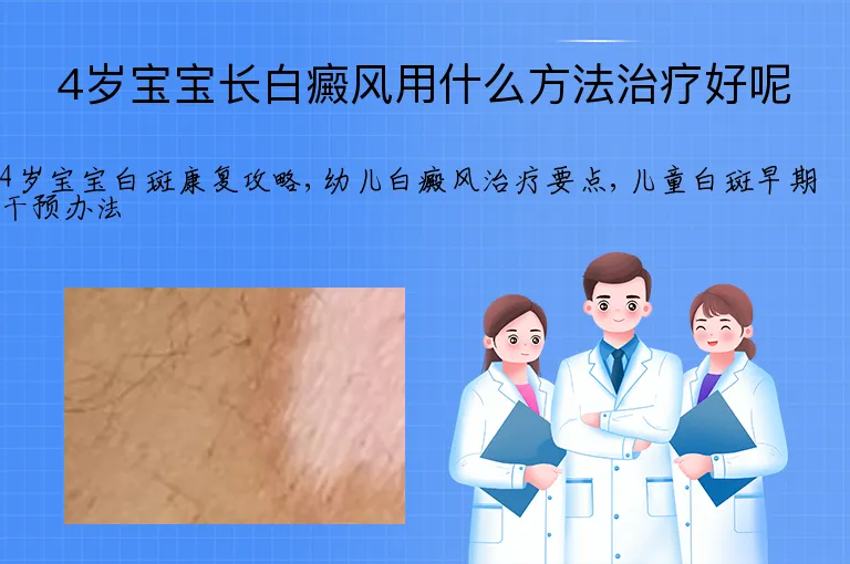 4岁宝宝长白癜风用什么方法治疗好呢