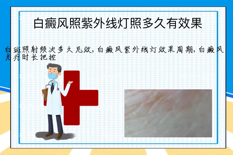 白癜风照紫外线灯照多久有效果