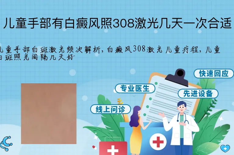 儿童手部有白癜风照308激光几天一次合适