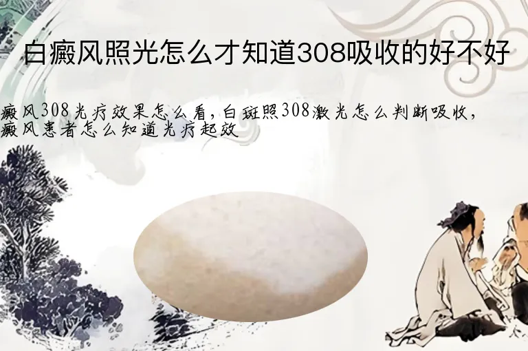 白癜风照光怎么才知道308吸收的好不好