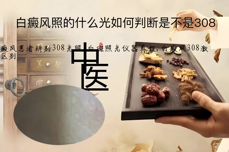 白癜风照的什么光如何判断是不是308