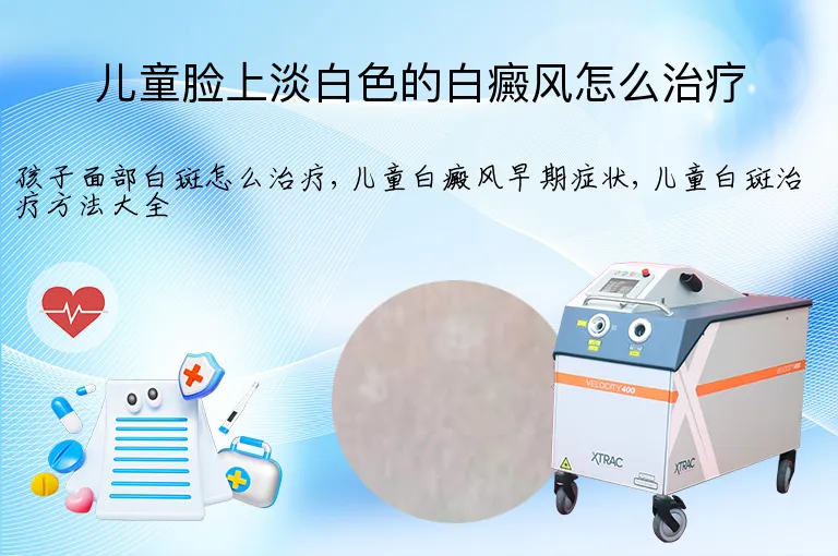儿童脸上淡白色的白癜风怎么治疗