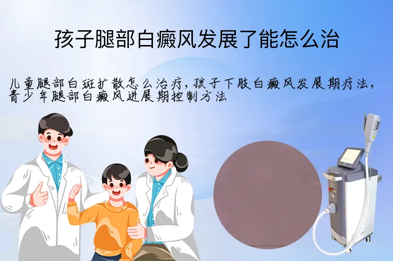 孩子腿部白癜风发展了能怎么治