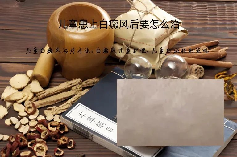 儿童患上白癜风后要怎么治