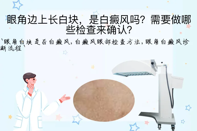眼角边上长白块，是白癜风吗？需要做哪些检查来确认？