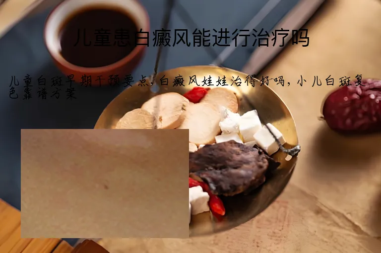 儿童患白癜风能进行治疗吗