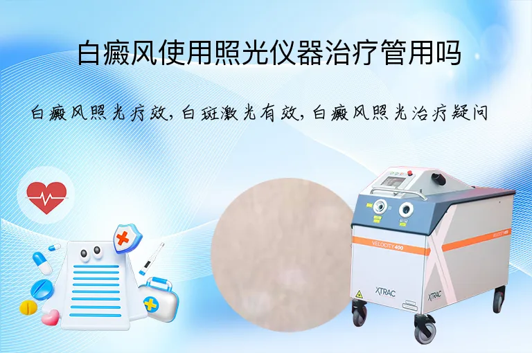 白癜风使用照光仪器治疗管用吗