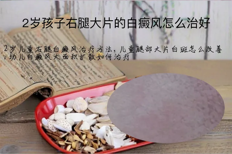 2岁孩子右腿大片的白癜风怎么治好