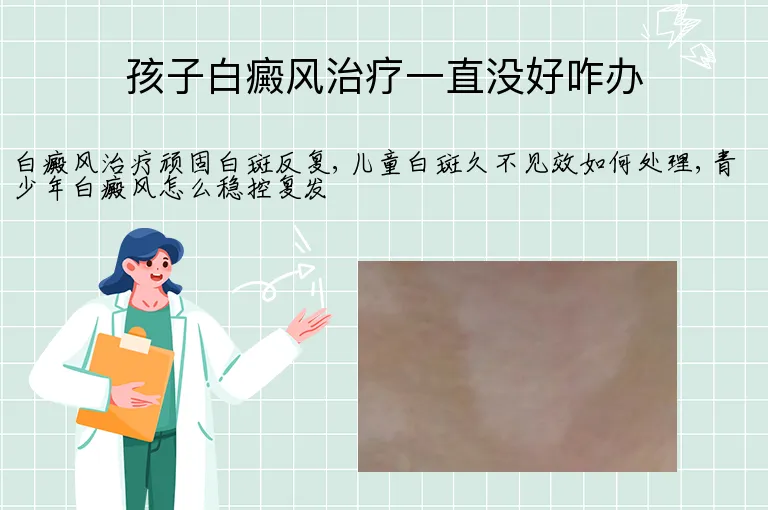 孩子白癜风治疗一直没好咋办