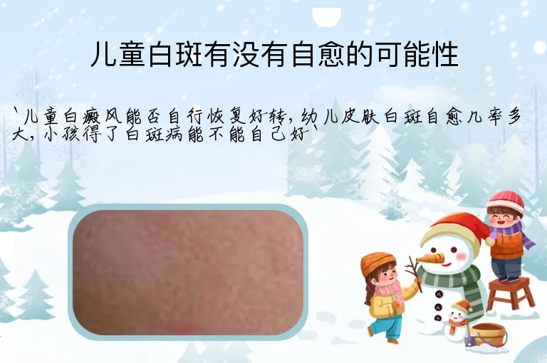 儿童白斑有没有自愈的可能性