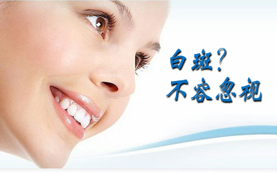 肢端型白斑症状都是什么样子的