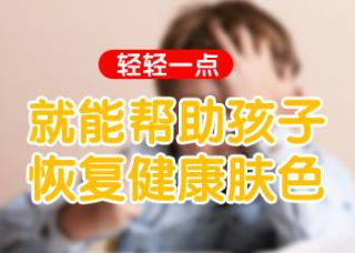 白癜风早期都有什么症状默示
