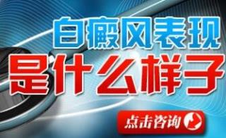 全身都得了白癜风应当怎样治疗