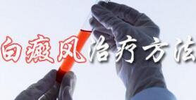 白癜风有哪些外部病因