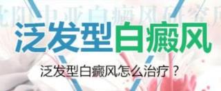 白癜风严酷的症状都有哪些
