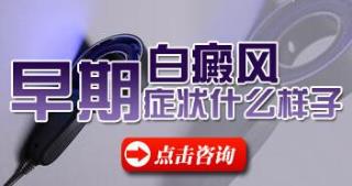 白癜风头上的早期症状有哪些