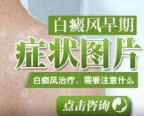 白癜风防止要按照病因来