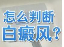 白癜风惹起缘由是什么