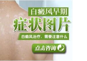 患者长白斑有哪些病因