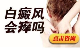 儿童白癜风初期症状清楚吗