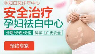 儿童白癜风会不会复发