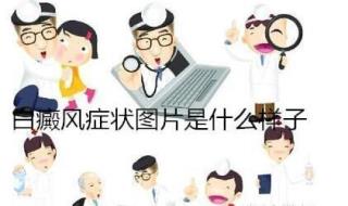 颈部的白癜风怎样治比拟好