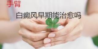 如何才干康复孩子身上的白癜风