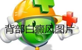 看好白癜风病院在哪里