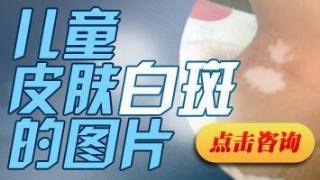 白癜风开初的症状是什么