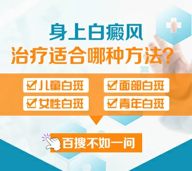 咨询身上白癜风适合哪种方法