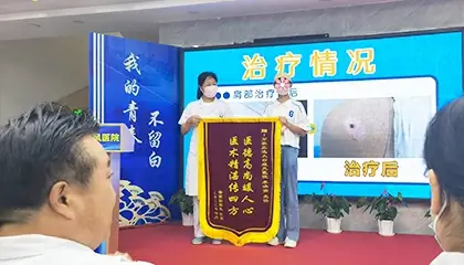 李洪燕医生白癜风治疗案例1